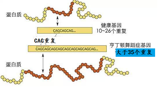 有毒的信使分子会导致亨廷顿舞蹈症吗？—ASO疗法新视角